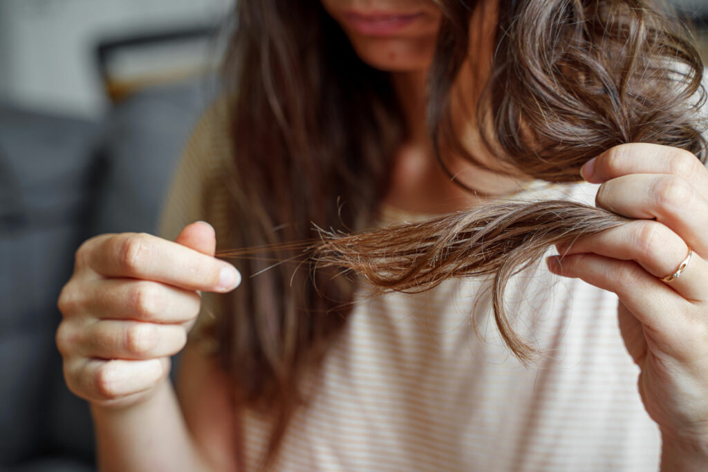 What Are the Causes of Hair Loss in Women?